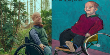 They Said He Was Limited…” — The Real Story of How Dr. Tom Shakespeare Challenged the System and Redefined Ability